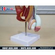 Mô hình bệnh lý hệ sinh dục nam giới